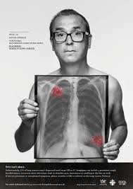 The shoulder had been an on going problem that i was having treatment for as a trapped nerve. Rankin Shoots Campaign To Raise Awareness Of Lung Cancer In People Who Ve Never Smoked Lbbonline