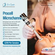 Specials - Allurecosmedic