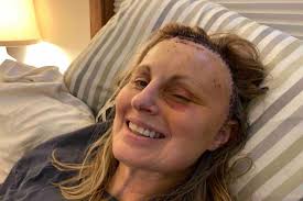 Fundraiser for Christina Nelson by Kaden Larson : Post Brain Surgery  Support for Tina