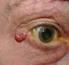 Image result for Centrostigma papillosum