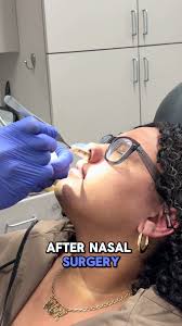 Quick home remedy for Nosebleeds #nosebleed #nose #mom #kids