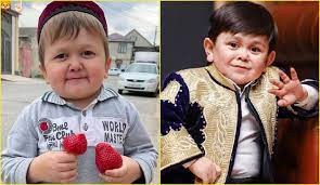 Hasbulla magomedov is experiencing a specific illness or condition. Dwarfism The Medical Condition That Makes Hasbulla Magomedov And Abdu Rozik Look Like Kids