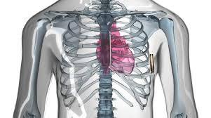 Molto fervida anche l'attività nell'ambito della ricerca scientifica: Lotta All Arresto Cardiaco Con Defibrillatori Sotto Pelle Benessere Quotidiano Net