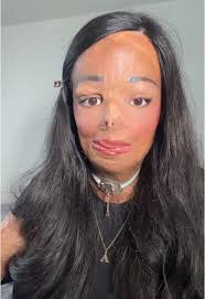 Aleema Ali Before and After