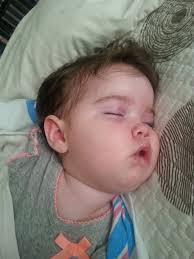 Praying for Koko's health update