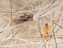 Image result for what do lice look like in dog fur