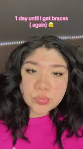 Pt 2 🫣🩷 #fyp #bracescheck #foryoupage #braceson #bracesjourney #fypa...