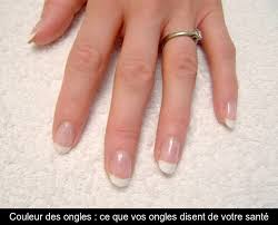 Petites anomalies des ongles : Couleur Des Ongles Ce Que Vos Ongles Disent De Votre Sante