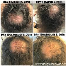 According to the cdc, hair on the scalp grows half an inch every month on average. Long Hairstyles To Cover Your Bald Spot Drugstore Divas