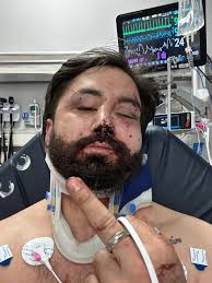 Hey there! I'm reaching out because I'm in a really tough spot and trying  to escape an abusive home where I've lived in fear for far too long. Every  contribution, no matter