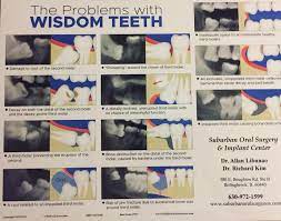 Suburban Oral Surgery And Implant Center Home Facebook