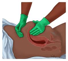 F Is For Fundal Massage Calming Waters Birth Services