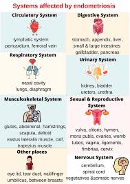 Endometriosis is a condition where tissue similar to the lining of the uterus is found outside of the uterine cavity (such as on the ovaries, fallopian tubes, or other pelvic structures). Endometriosis Awareness Posts Facebook
