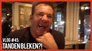Deze week wordt rené watzema geboeid door rijk. Gordon Laat Gebit Renoveren Maar Niet Zo Wit Als Tanden Van Geer Show Ad Nl