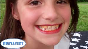 Rotten Teeth (WK 127.5)