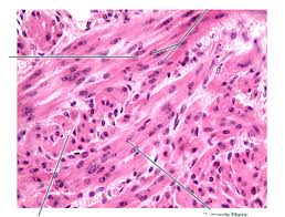 As in cardiac muscle cells, the configuration of the nuclear membranes in smooth muscle cells changes during contraction and. Smooth Muscle Tissue Diagram Quizlet