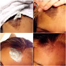 Use an oil as a cleanser. How To Get Hair Dye Off Your Skin Musely