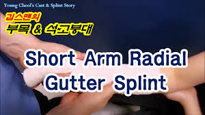 Image result for Radial Gutter Cast