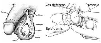 Testicular cancer warning signs include a testicular lump, back pain, swelling, and infection. Testicular Cancer Public Health Student Wellness Center Ut Dallas