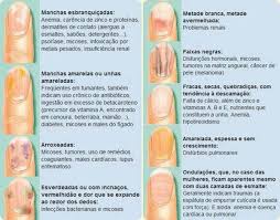Muitas vezes, estas são as únicas marcas de psoríase na pessoa. Nail Art Deisysantos Deisysantosnail Twitter