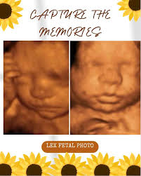 Lexington Fetal Photography