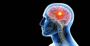 De asemenea, include componenta periferica a sistemului nervos autonom. Simptome Neurologice Asociate Noului Coronavirus Studiu Neuroaxis