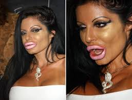 10.09.2021 · tori spelling is opening up about those plastic surgery rumors. Plastic Surgery Gone Wrong 001 Funcage