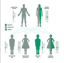 Image result for Muscular Dystrophy