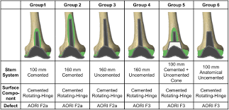 Flush mount anderson plug uke. Supplemental Materials For Comparative Biomechanical In Vitro Study Of Different Modular Total Knee Arthroplasty Revision Stems With Bone Defects The Journal Of Arthroplasty