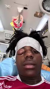 IShowSpeed госпитализирован [NR]