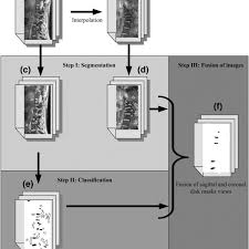 Flowchart Of The Novel Automatic Segmentation Process Flow