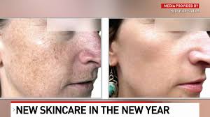 Revive skin ravaged by holiday excess and winter weather
