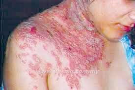 Последние твиты от kayap (@ypipin). Twtkecantikan On Twitter Contoh Kayap