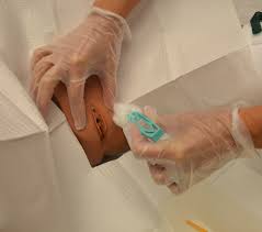 10.4 Urinary Catheters – Clinical Procedures for Safer Patient Care