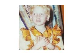 I was born with white hair, light colored eyes & pale skin. I was ...