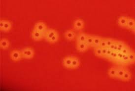 Image result for Group D Streptococcus