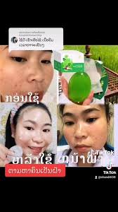 ດາປ໊ອບສະກິນ