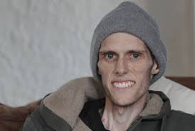 Stricken by cancer, defined by faith