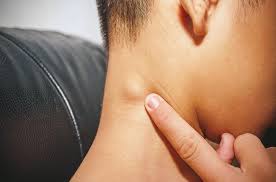Posterior lymph nodes are located along the back of the neck. Tmj Causing The Swollen Lymph Nodes Tmj And Sleep