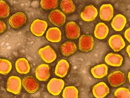 Early symptoms include high fever and fatigue. Il Giorno Dell Addio Al Vaiolo Wired