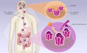 This cell type typically forms in separate nodes or lesions. Peritoneal Mesothelioma Peritoneal Mesothelioma Wiki Peritoneal Mesothelioma Wiki