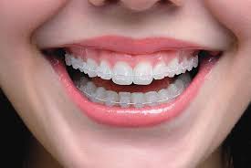 Pin On Teeth Whitening In Gurgaon Sector 43