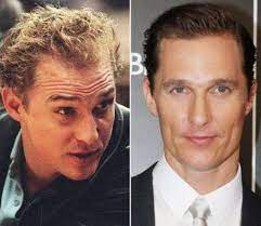 Most insurance plans don't cover it. Pin On Celebrity Hair