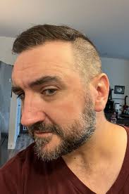 Cutting own hair due to sensory issues and social discomfort