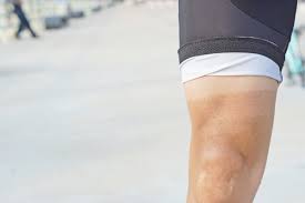 A tan line can be simply said as the color division of human skin of one area which is more exposed to the sun in compare with the areas less exposed. Cycling Tan Lines In Women How You Can Avoid Them