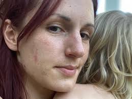 Fundraiser by Tansen Halverson : Help Tansen afford therapy for C-PTSD