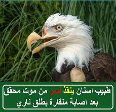 طبيب اسنان ينقذ نسر من موت محقق بعد اصابة منقارة بطلق ناري انقاذ نسر من موت محقق على جزيرة فانكوفر والتي تقع في المقاطعة ا bald eagle animals eagle