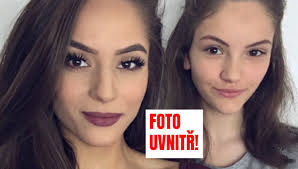 V luxusní turecké restauraci byla totiž silně popálena a oheň zasáhla až 35 procent jejího těla. Tynus Tresnickova Opet Ukazala Snimek Z Nemocnice Tentokrat Se Svoji Sestrou Evropa 2