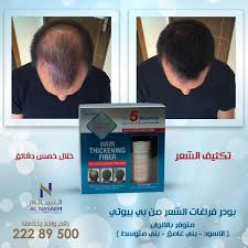 تكثيف الشعر خلال ٥ دقايق فقط مع بودر الفراغات من بي بيوتي المتوفر لدى شركة النسائم لمواد وأدوات التجميل Hair Thickening Incoming Call Screenshot Baseball Cards