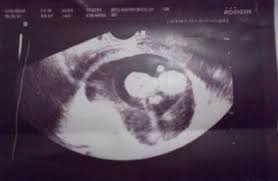 Get to know what you need to take care of when 10 weeks pregnant pregnant. What To Expect When You Re 10 Weeks Pregnant